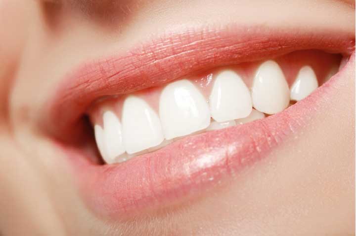 How to Whiten Your Teeth at Home