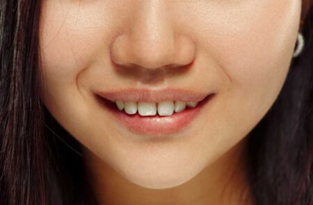 Maintain Attractiveness of Your Smile by Treating Diastema