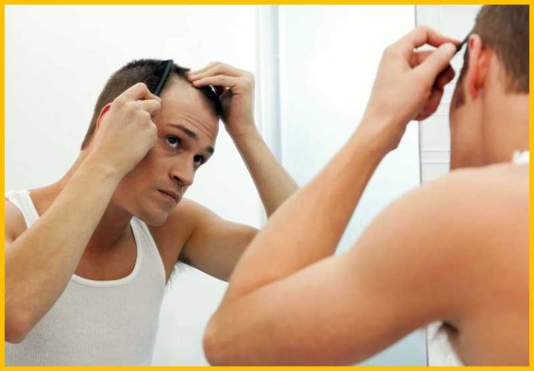 Male Hair Loss