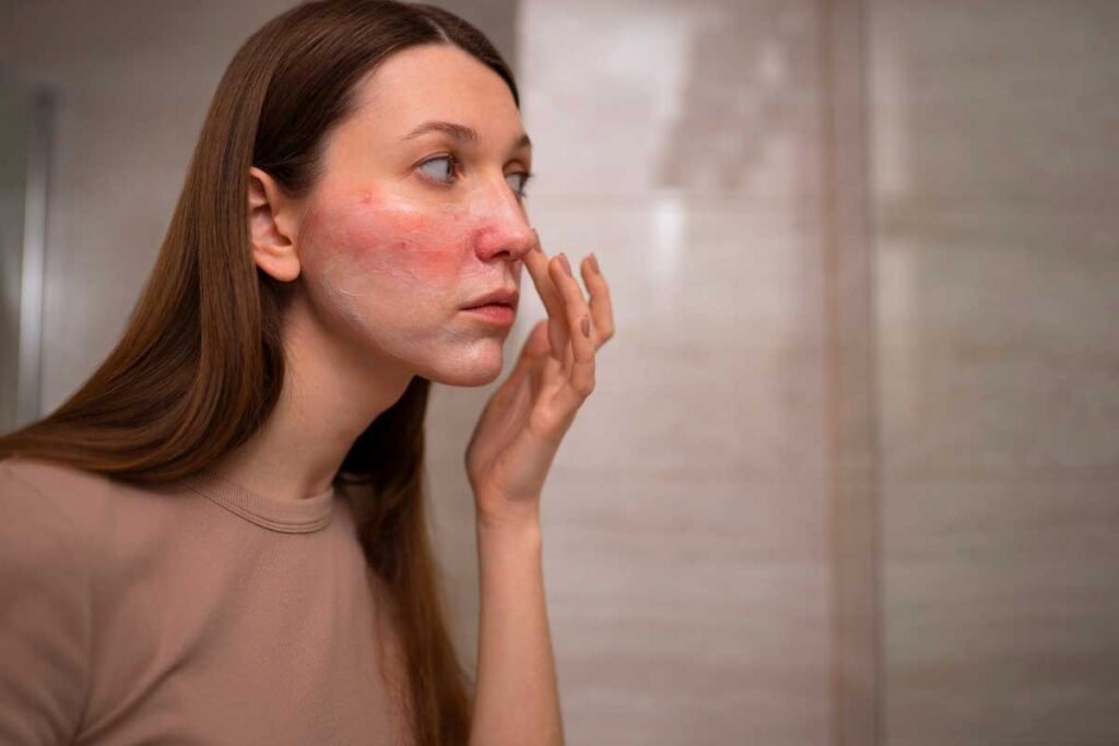 Understanding Skin Redness: Why Some Skin is More Prone