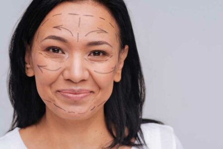 What is a thread lift facelift?